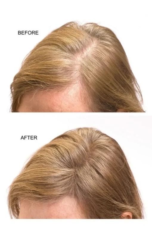 Joan Rivers Beauty Great Hair Day I